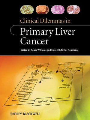 cover image of Clinical Dilemmas in Primary Liver Cancer